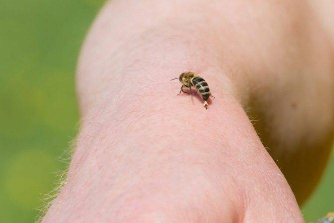 Что делать если укусила оса или пчела