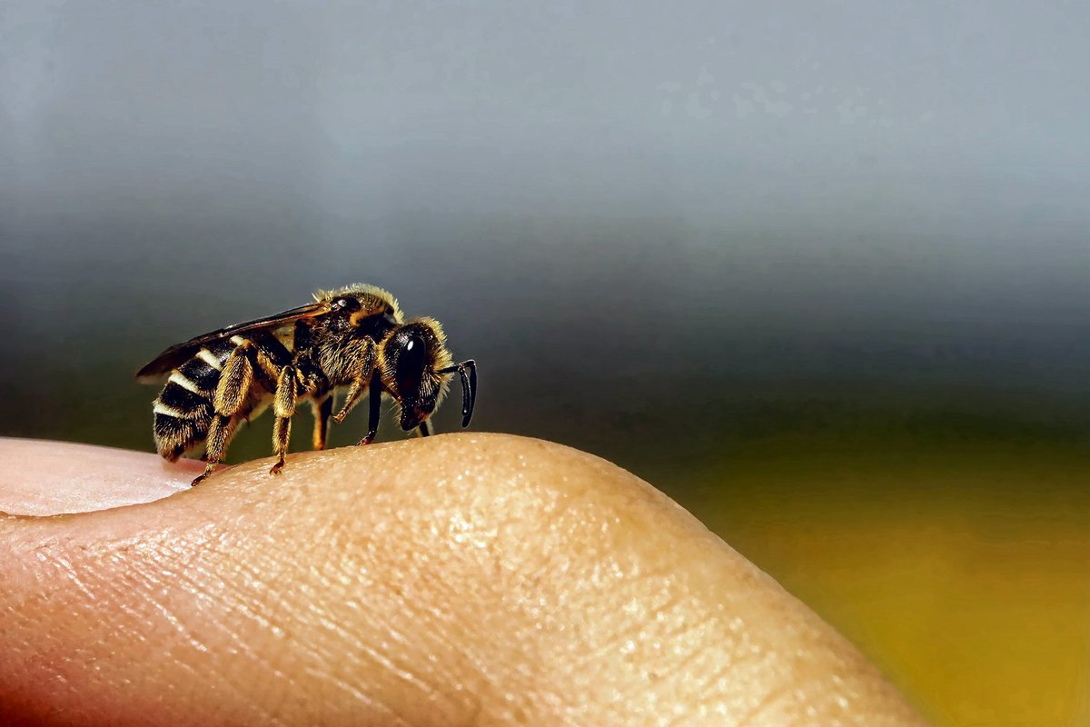Как убрать отечность после пчелиного укуса?