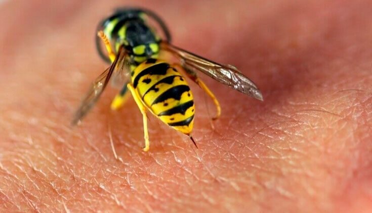 Что делать если укусила пчела?
