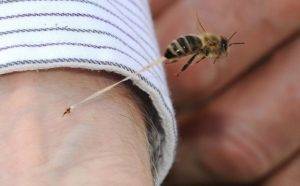 Что делать, если укусила пчела?