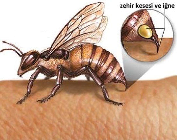 Жало пчелы – орган для самозащиты насекомого