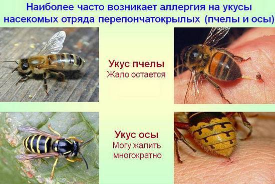 Как снять опухоль от укуса пчелы, чем убрать боль и покраснение, что делать