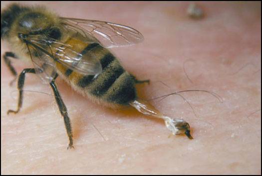 Что делать, если укусила пчела или оса? :: инфониак