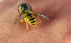 Первая помощь при укусе пчелы