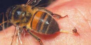 Укус пчелы что делать в домашних условиях: первая помощь, чем лечить пчелиный укус, последствия