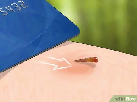 Пошаговая инструкция: что делать, если укусила оса