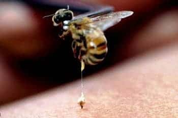Пчелиный яд (апитоксин) – польза и вред апитерапии, инструкция к применению, препараты (крем софья, бальзам живокост, гель 911, мазь вирапин), лечение различных заболеваний