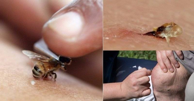 Как лечиться укусами пчел в домашних условиях