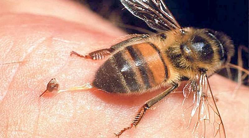 Как снять отек укуса пчелы в домашних условиях