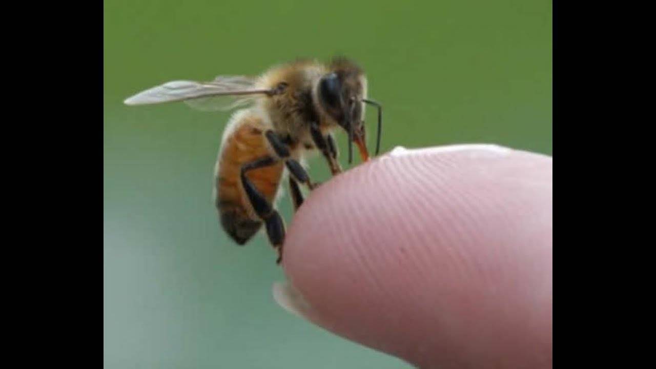 Правила первой помощи при укусе пчелы