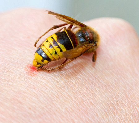 Первая помощь при укусе пчелы?