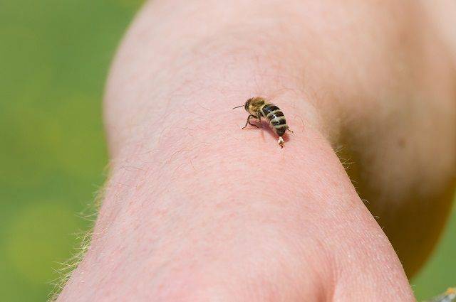 Укусила пчела – что делать в домашних условиях, неотложная доврачебная помощь